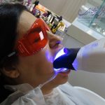 ایمپلنت با تکنولوژی جدید