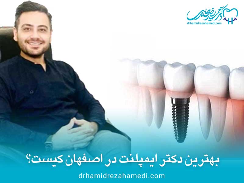 بهترین دکتر ایملنت در اصفهان
