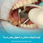 قیمت ایمپلنت دندان در اصفهان
