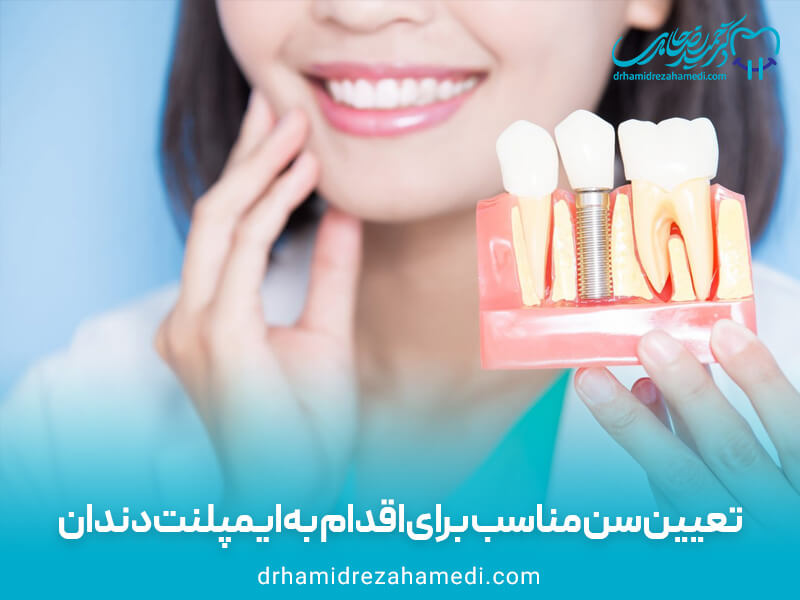 تعیین سن مناسب برای اقدام به ایمپلنت دندان