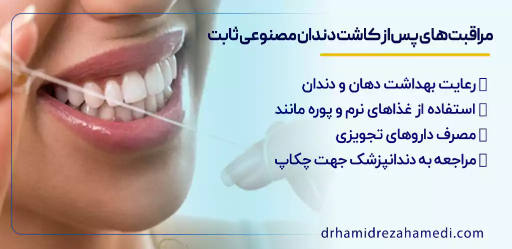 مراقبت‌های پس از کاشت دندان مصنوعی ثابت