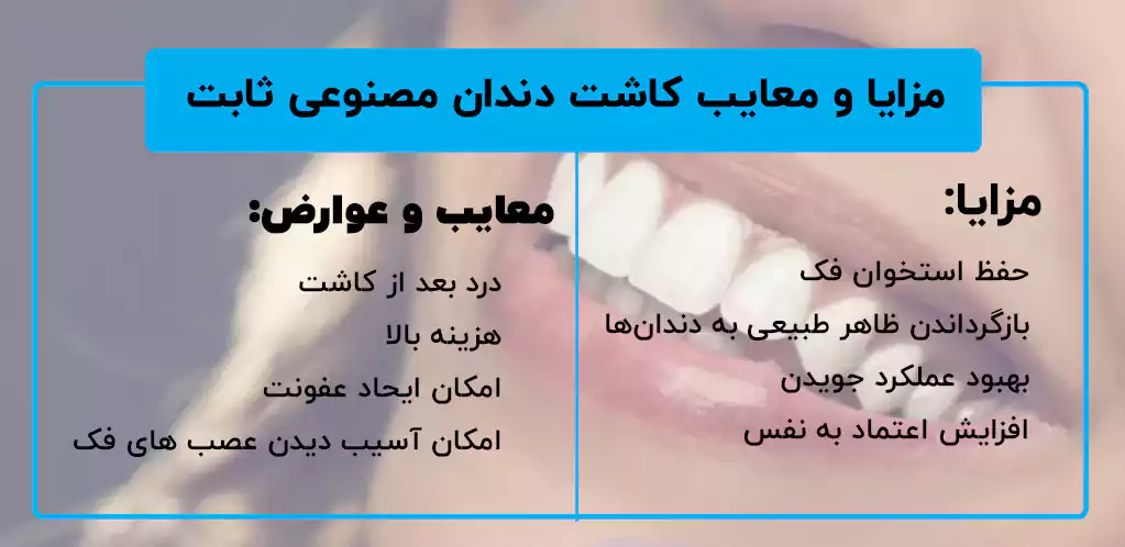 مزایا و معایب کاشت دندان مصنوعی ثابت